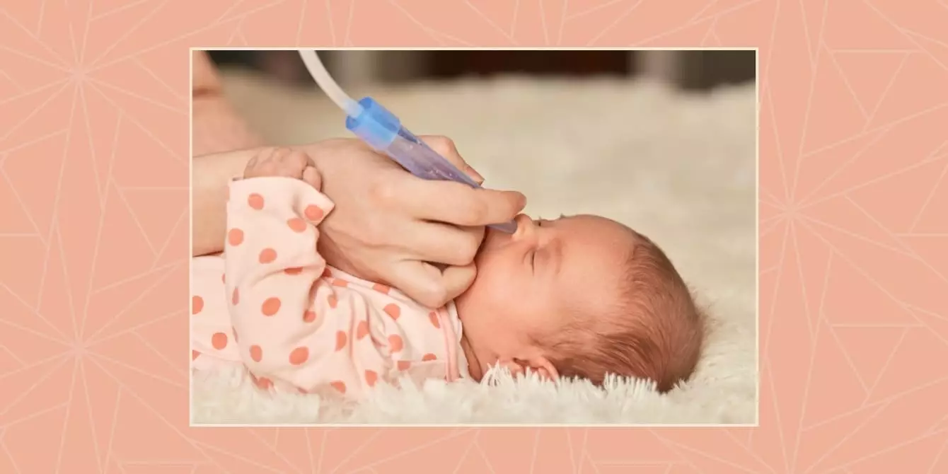 Understanding Baby Congestion: Tips for Comfort and Relief